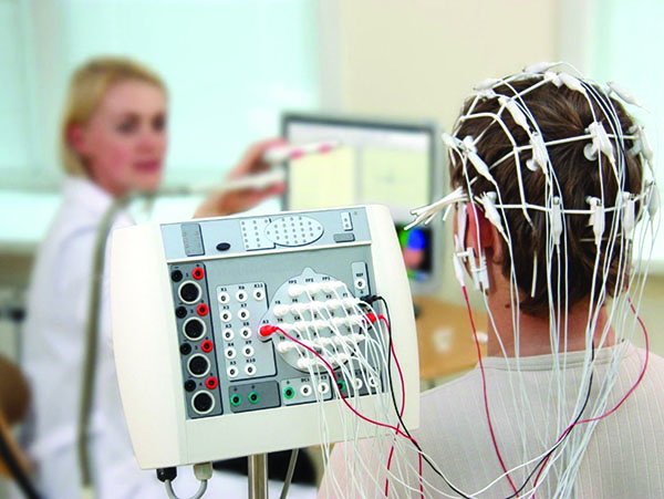 ELECTROENCEPHALOGRAM (EEG)