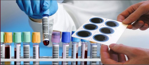 SEROLOGY